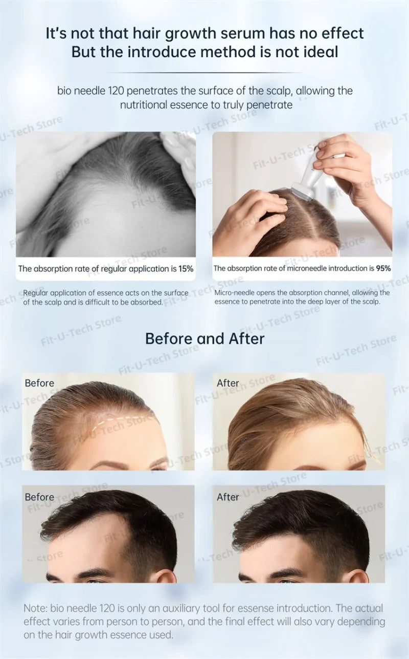 Titanium Derma Stamp