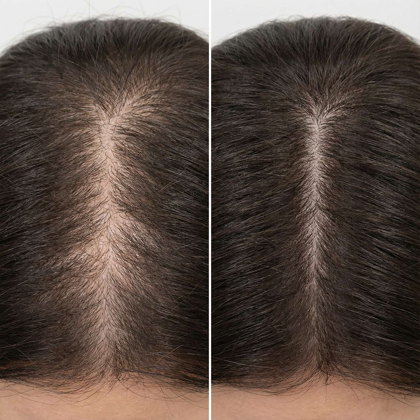 Noora's 3-1 Red Light Therapy Scalp Massager